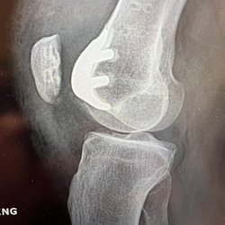 Thomas Kovack, DO - Advantage Orthopedics