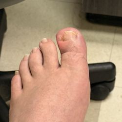 Lake Urgent Care - Galvez - Still dealing with the infected toe doctor did nothing but look at it. That must've been a very expensive look at.