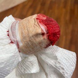 Northwestern Medicine Immediate Care - Bartlett - Injury