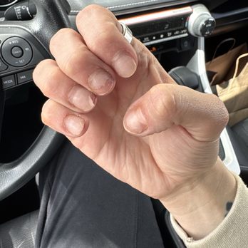 Pro Nails - My nails before I came to pro nails (again tragic) - Nail Salons Near Me - Brisbane, California