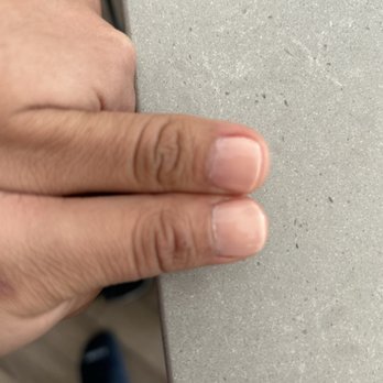 XOXO Nail Bar - My thumbs. One is so much shorter but in person it looks and feels worse - Nail Salons Near Me - Irvine, California XOXO Nail Bar - My thumbs. One is so much shorter but in person it looks and feels worse - Nail Salons Near Me - Irvine, California