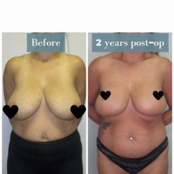 Swet Chaudhari, MD - SunCoast Plastic Surgery