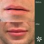 Limelight Medical Aesthetics