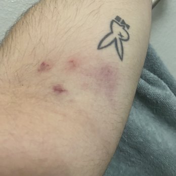 Sharp Grossmont Hospital - Very traumatizing experience - Hospitals Near Me - La Mesa, California Sharp Grossmont Hospital - Very traumatizing experience - Hospitals Near Me - La Mesa, California