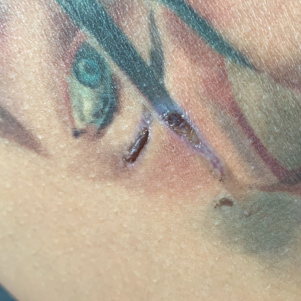 Integrity Aesthetics, MD - They burn my skin so bad ! - Laser Hair Removal Near Me - Pleasant Hill, California Integrity Aesthetics, MD - They burn my skin so bad ! - Laser Hair Removal Near Me - Pleasant Hill, California