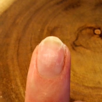North Hollywood Nails - Uneven with ragged edge. - Nail Salons Near Me - Los Angeles, California North Hollywood Nails - Uneven with ragged edge. - Nail Salons Near Me - Los Angeles, California