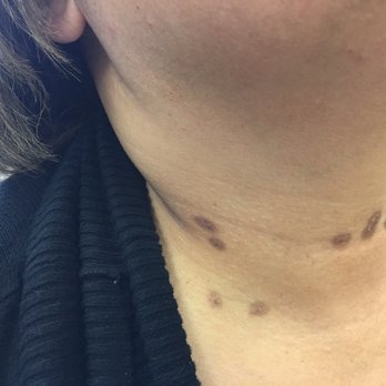 Applegarth Dermatology, PC - Dermatologists Near Me - Valparaiso, Indiana Applegarth Dermatology, PC - Dermatologists Near Me - Valparaiso, Indiana