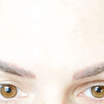 RBF PDX - 1 month after Botox injection between brows and two units on forehead. - Aestheticians Near Me RBF PDX - 1 month after Botox injection between brows and two units on forehead. - Aestheticians Near Me