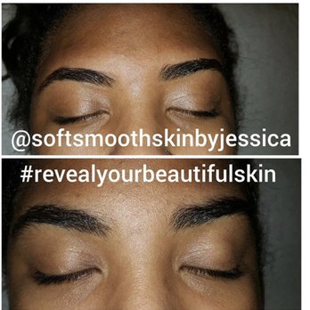 SoftSmoothSkinbyJessica - Eyebrow wax Before & After
Hard wax - Skin Care Near Me SoftSmoothSkinbyJessica - Eyebrow wax Before & After
Hard wax - Skin Care Near Me