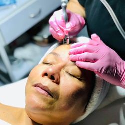 Bloom Skincare Lounge - Microdermabrasion Facial