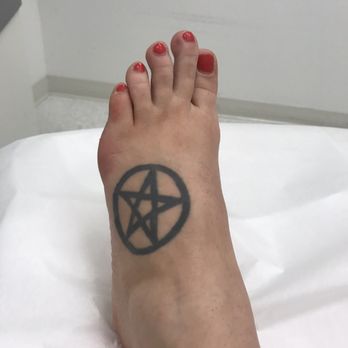 Zapatat - Before any removal procedures. - Tattoo Removal Near Me - Arlington, Virginia