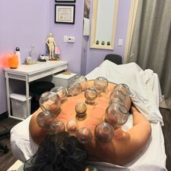 Awaken Remedies - Fire cupping