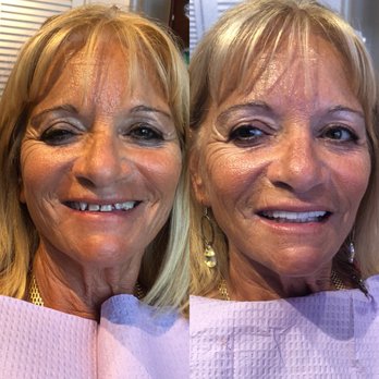 Mitchell A Josephs, DDS - General Dentistry Near Me - Palm Beach, Florida Mitchell A Josephs, DDS - General Dentistry Near Me - Palm Beach, Florida