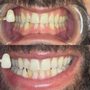 Photo of Fairywhite Teeth Whitening