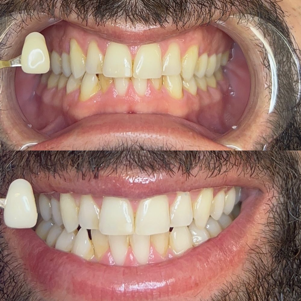 Fairywhite Teeth Whitening Logo