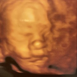Heavenly 3D 4D Ultrasound