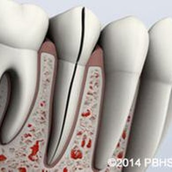 Manatee Endodontics - untitled - Endodontists Near Me - Bradenton, Florida Manatee Endodontics - untitled - Endodontists Near Me - Bradenton, Florida