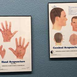 Polly's Chiropractic - Dr Polly does acupuncture for MANY conditions