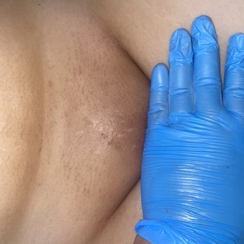 Studio Bee Waxed - After a Brazilian wax! - Waxing Near Me - Pasadena, Texas Studio Bee Waxed - After a Brazilian wax! - Waxing Near Me - Pasadena, Texas