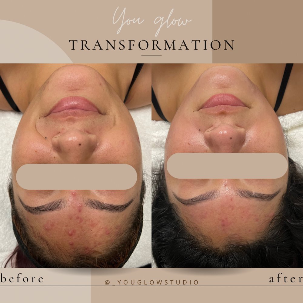 You Glow Studio Logo