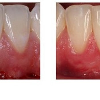 Peter A Russo - Periodontists Near Me - Huntington Beach, California Peter A Russo - Periodontists Near Me - Huntington Beach, California