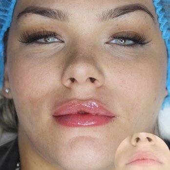 Baroque Beauty Center - My girlfriend just did her lips there with Antonio and she looks gorgeous. Very satisfied !!! - Permanent Makeup Near Me - Las Vegas, Nevada Baroque Beauty Center - My girlfriend just did her lips there with Antonio and she looks gorgeous. Very satisfied !!! - Permanent Makeup Near Me - Las Vegas, Nevada