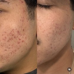 Nami Skin Care & Electrolysis