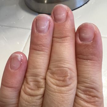 Classy Nails Spa - Acrylic bits and pieces still left on nails..my fingers look so ugly now... - Nail Salons Near Me - San Ramon, California Classy Nails Spa - Acrylic bits and pieces still left on nails..my fingers look so ugly now... - Nail Salons Near Me - San Ramon, California