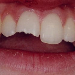 Michael Steinmetz, DDS - Root canal dentist cincinnati