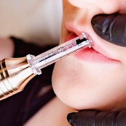 Alpha Woman Studios - Needless lip fillers
