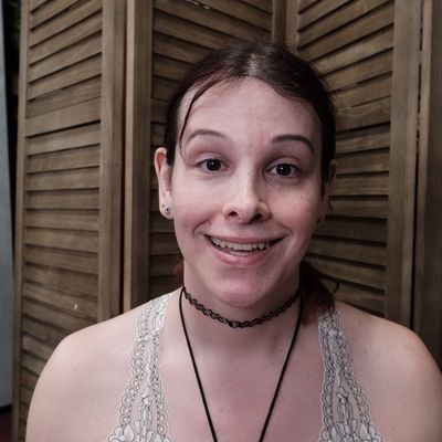 Photo of Deschamps-Braly Clinic of Plastic & Craniofacial Surgery - San Francisco, CA, US. No makeup. Learning to smile with teeth?