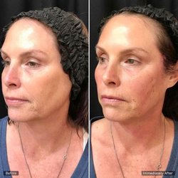 Gray Dermatology & Cosmetic Surgery