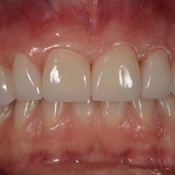 Jacob Shrayman, DDS - After