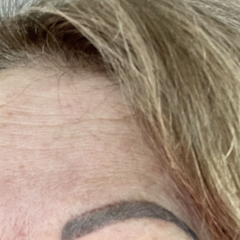 Chic Spa Microblading Academy - Brown lines against darker brows. - Eyelash Service Near Me - Avon, Connecticut Chic Spa Microblading Academy - Brown lines against darker brows. - Eyelash Service Near Me - Avon, Connecticut
