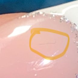 hair stuck in my nail.