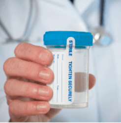 Urine Drug Testing - Urine Drug Testing Urine Drug Testing - Urine Drug Testing