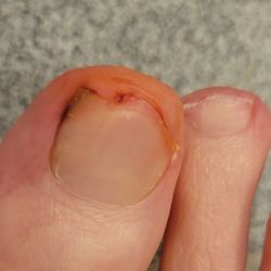 PA Foot & Ankle Associates