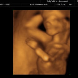 Baby's First Ultrasound