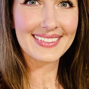 The Skin Bar - My skin recently after seeing Kaylynn for 3 years, almost completely melasma free! - Skin Care Near Me - Gilbert, Arizona The Skin Bar - My skin recently after seeing Kaylynn for 3 years, almost completely melasma free! - Skin Care Near Me - Gilbert, Arizona