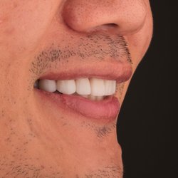 Doncaster Hill Dental