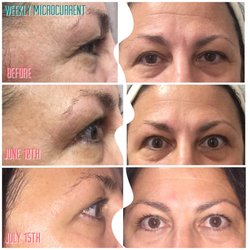 Pure Illumination Skincare Studio & Boutique - Microcurrent Treatments