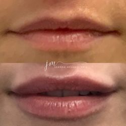 Nuveau Plastic Surgery & Medical Aesthetics