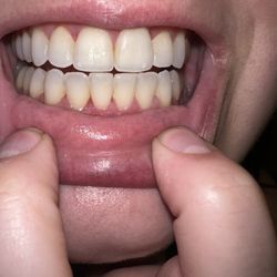 Laski M. Kung, DDS - After :)