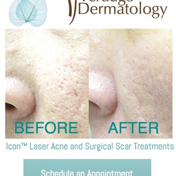 Verdugo Dermatology - Contact Verdugo Dermatology Today to learn more about laser scar removal 818-658-2300. - Dermatologists Near Me - Glendale, California Verdugo Dermatology - Contact Verdugo Dermatology Today to learn more about laser scar removal 818-658-2300. - Dermatologists Near Me - Glendale, California