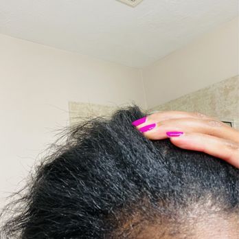 360 Degrees Hair Studio - BURNT SCALP AND SORE - Hair Salons Near Me - Pearland, Texas 360 Degrees Hair Studio - BURNT SCALP AND SORE - Hair Salons Near Me - Pearland, Texas