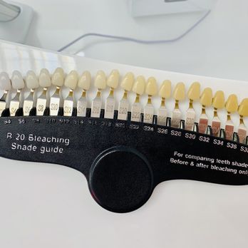 britebar - What I didn't know before this was that there were actually grades of teeth whiteness! - Teeth Whitening Near Me - Los Angeles, California britebar - What I didn't know before this was that there were actually grades of teeth whiteness! - Teeth Whitening Near Me - Los Angeles, California