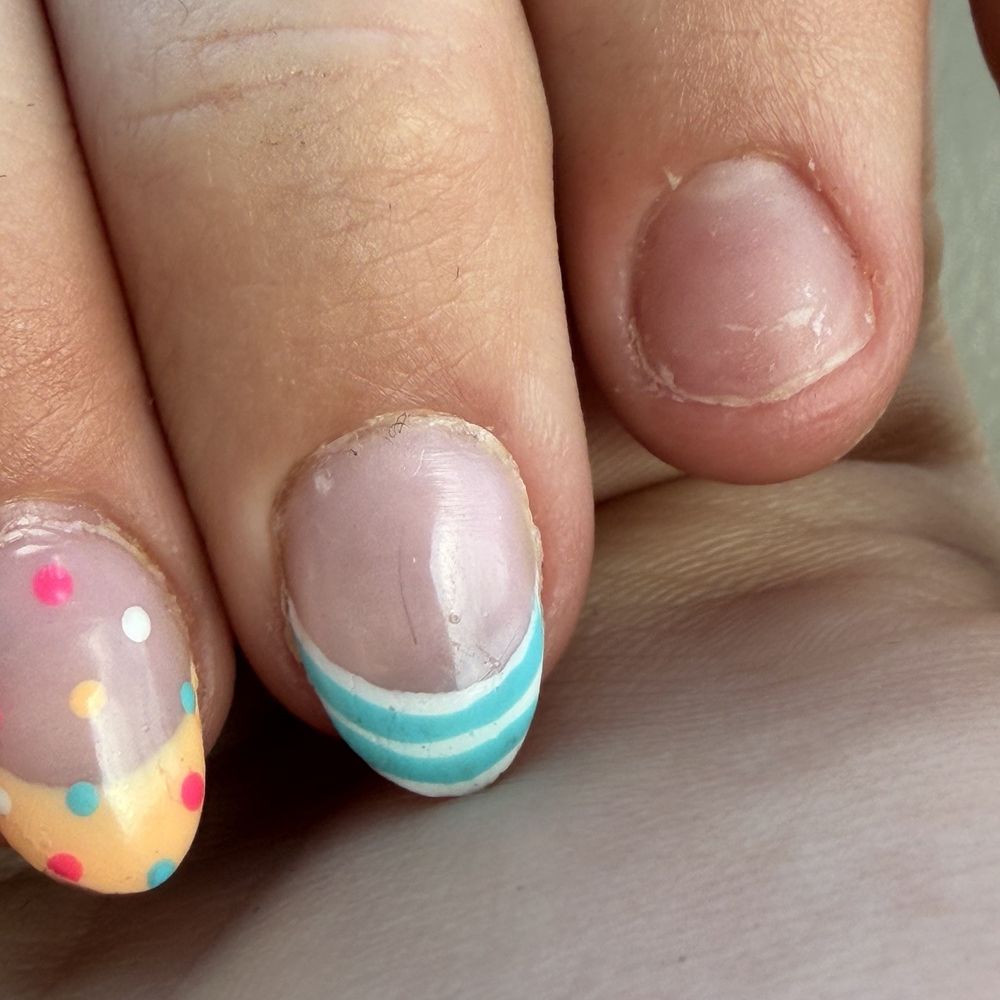 Glitz Nail & Lashes - Hair in the nails on middle finger, and uneven lines also another missing nail - Nail Salons Near Me - Meridian, Idaho Glitz Nail & Lashes - Hair in the nails on middle finger, and uneven lines also another missing nail - Nail Salons Near Me - Meridian, Idaho