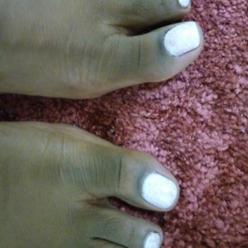 KB Nails - raggedy gel pedi (This is one day later.) - Nail Salons Near Me - Sacramento, California KB Nails - raggedy gel pedi (This is one day later.) - Nail Salons Near Me - Sacramento, California