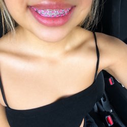 Inglewood Dental & Orthodontics - Braces