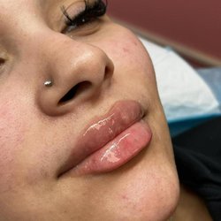 GlamGrin Medical Spa